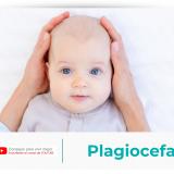 Cómo evitar y tratar la plagiocefalia en los bebés