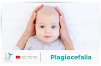 Cómo evitar y tratar la plagiocefalia en los bebés